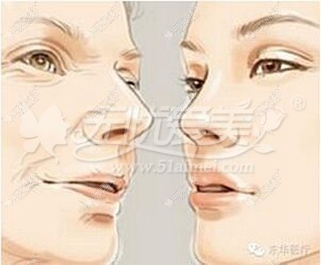 成都爵丽自体脂肪面部微雕怎么样