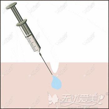 u=3736205147,3778717849&fm=26&gp=0.jpg
