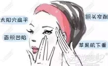 玻尿酸填充改善的面部状态