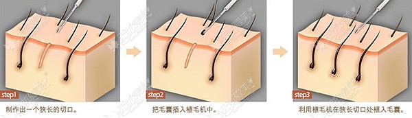 不触碰技术