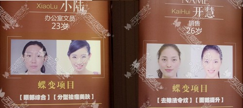 二楼楼梯口案例