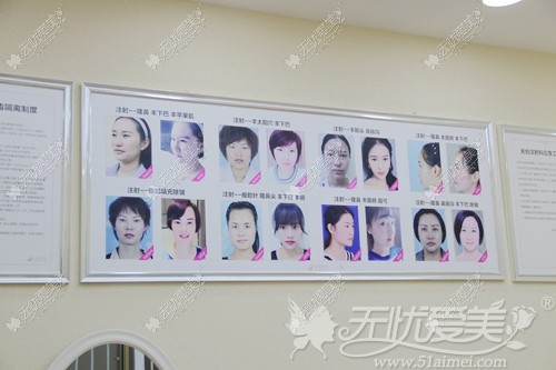 昆明丽都整形案例 昆明丽都整形案例