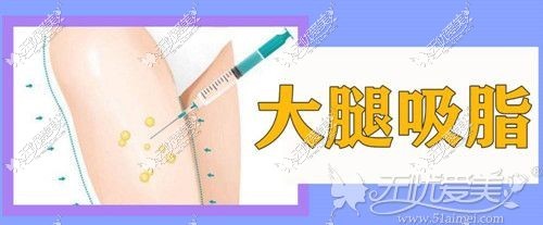 大腿吸脂手术可以甩掉大象腿
