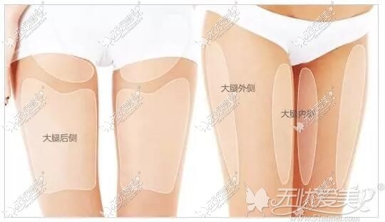 大腿吸脂部位