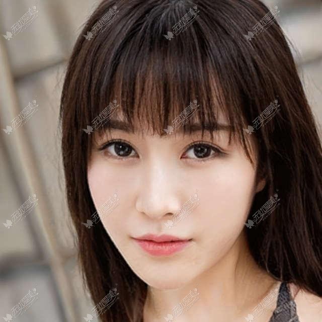 找郑州菲林骆毅做自体脂肪填充法令纹后晓得脸为什么会鼓