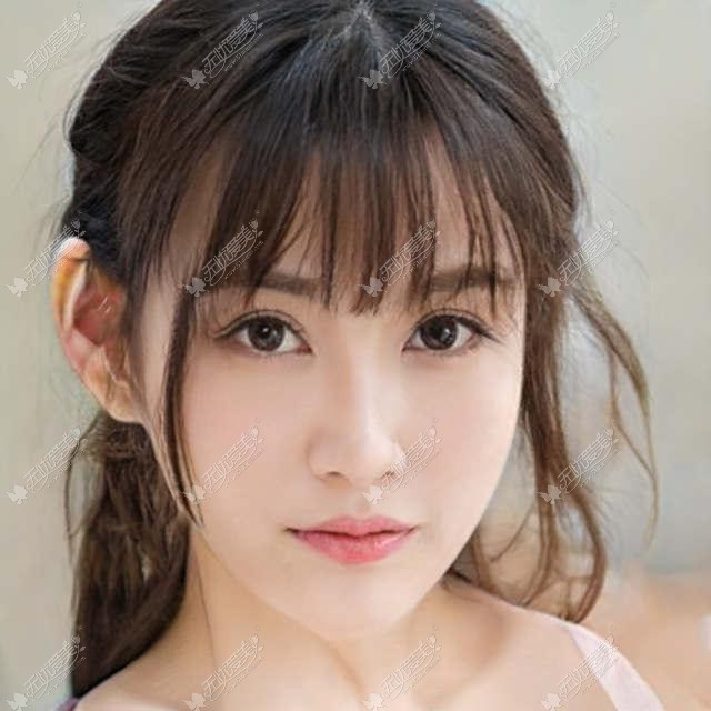 郑州私密整形哪家好?张朝蕾德国Fotona欧洲之星让你紧致如初