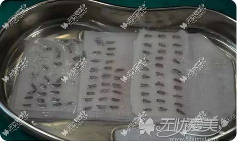 等待植入的毛发