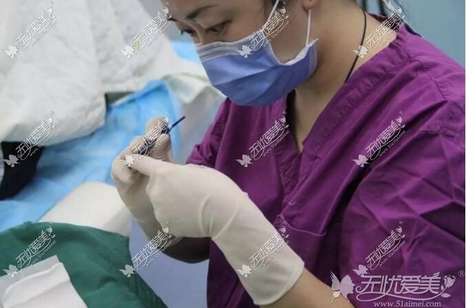 植发医生的水平很重要