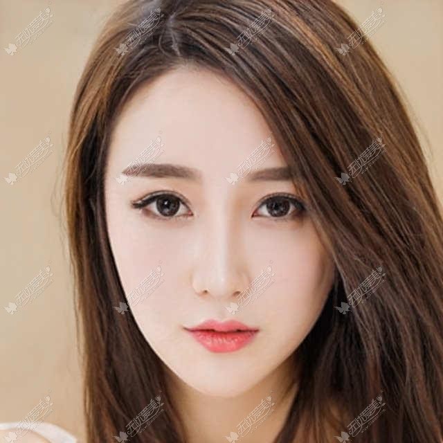 隆鼻修复后 终于恢复了自信