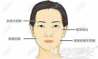 面部凹陷的真正原因