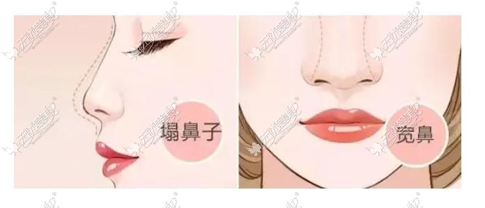 深圳富华谢福庚做鼻子好看
