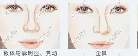 唐新辉做鼻子怎么样www.51aimei.com