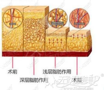 德国水动力形态雕塑原理
