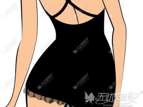莆田维纳斯腰部吸脂