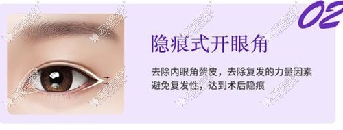 衡阳美莱割双眼皮技术