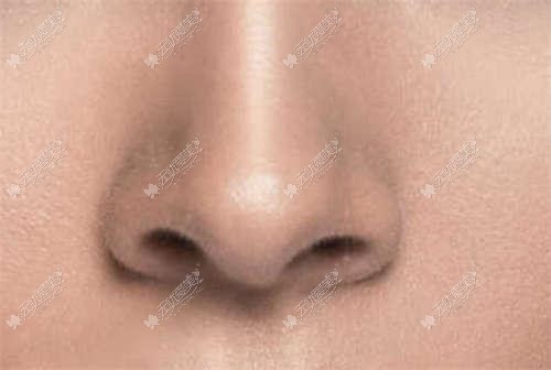 韩式隆鼻术的操作标准是什么?