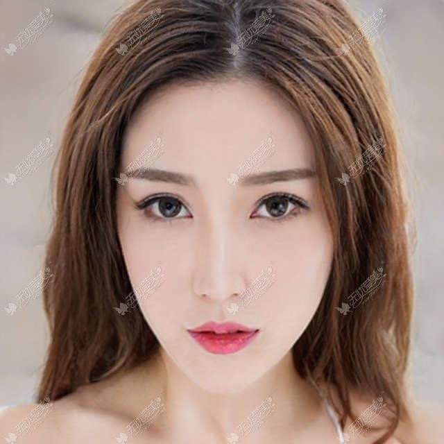 合肥壹加壹合肥韩美去眼袋哪家好