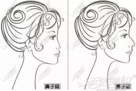 塌鼻子和挺翘鼻子