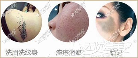 呼和浩特大韩整形洗眉洗纹身
