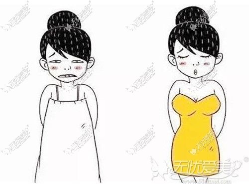 平胸适合做多大的假体