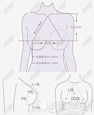 假体隆胸需要考虑的胸部基础