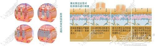 点阵激光的原理