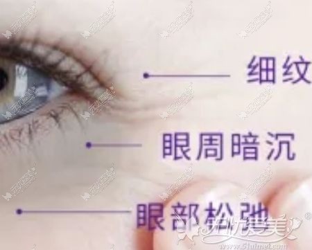 眼周出现的衰老状态