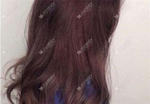 产后阴道松弛想做菲蜜丽激光不知道疼不疼？重庆华美有话