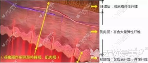 菲密丽在治疗阴道紧缩上的作用原理