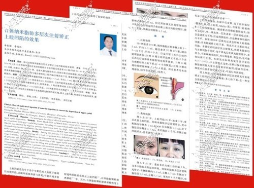 论文刊登杂志