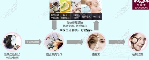 玉溪左医生激光祛斑疗程