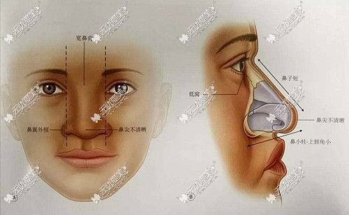 崔东做鼻子怎么样