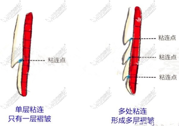 宁波薇琳的彭鑫医生的口碑