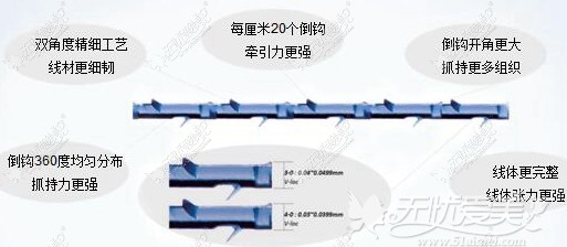 惠州鹏爱面部线雕采用新型V-Loc可吸收线材