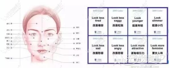 玻尿酸能够改善的各个面部情绪点