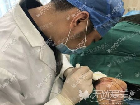 做埋线提升的过程