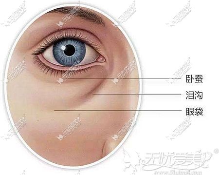 眼袋的存在位置和形态