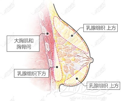 韩国麦恩自体脂肪隆胸术优势