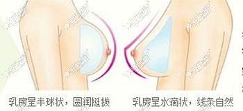 美胸标准