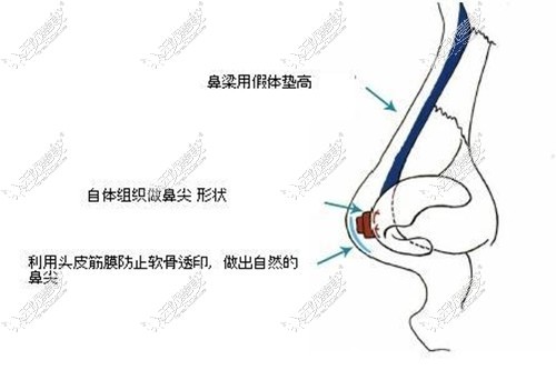 筋膜垫鼻尖的原理