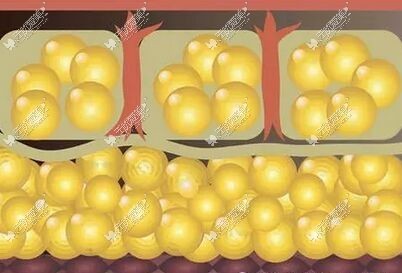 深圳面部脂肪填充