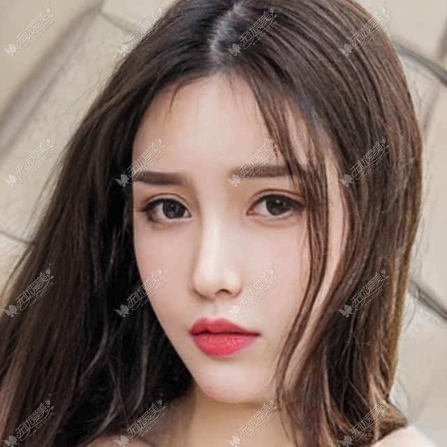 潍坊博雅医学整形美容医院做双眼皮费用是多少