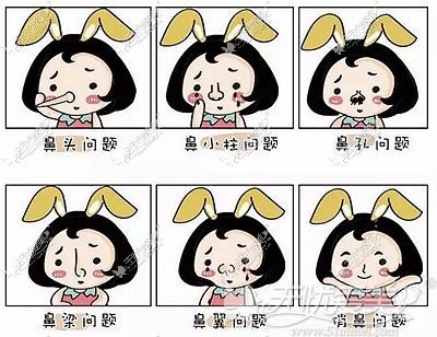鼻综合可以改善多种不理想鼻型
