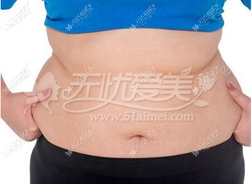 肥胖游泳圈