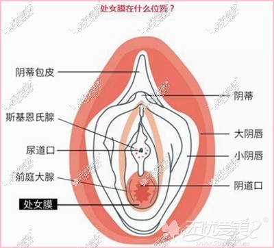 呼和浩特诺伊美处女膜修复术