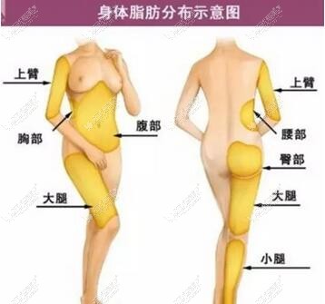 常见的吸脂部位