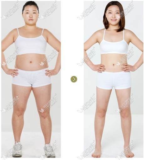 韩国隆胸and吸脂整形 术后护理很重要