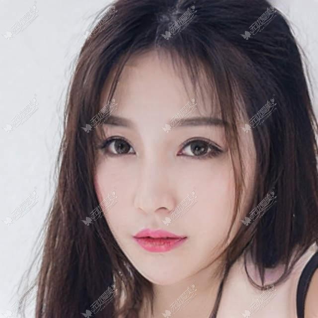 与其到处问吃什么能排出黑色素沉淀不如试试激光治疗