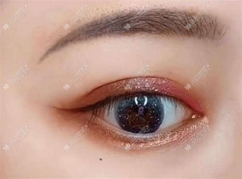 惠州伊美激光美肤多少钱?黑脸娃娃1180元起帮你美肤
