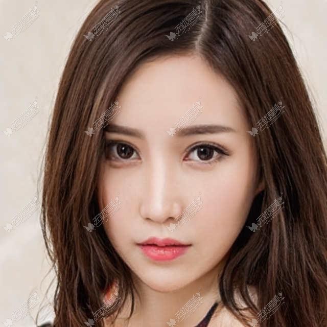 做完埋线双眼皮眼尾有线结怎么办？可千万不要自己处理哦